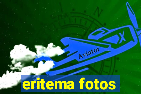 eritema fotos